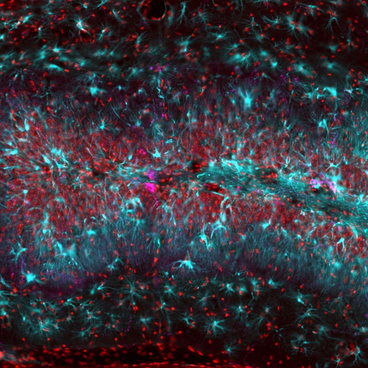 Fluorescence microscope image of transplanted inhibitory interneurons, shown in cyan, woven through the hippocampus, shown in red